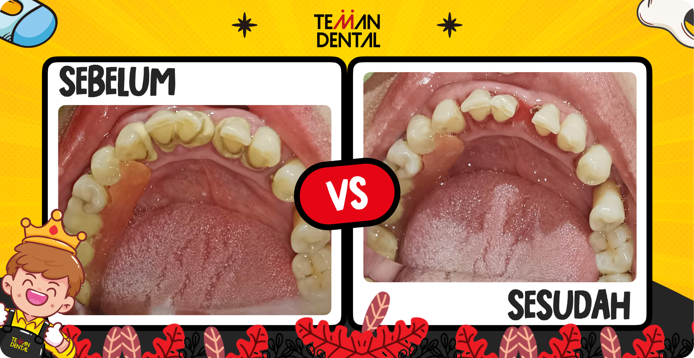 Foto testimoni Nizar setelah scaling